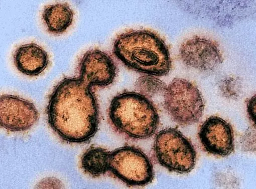 SARS-CoV-2, el virus que causa COVID-19